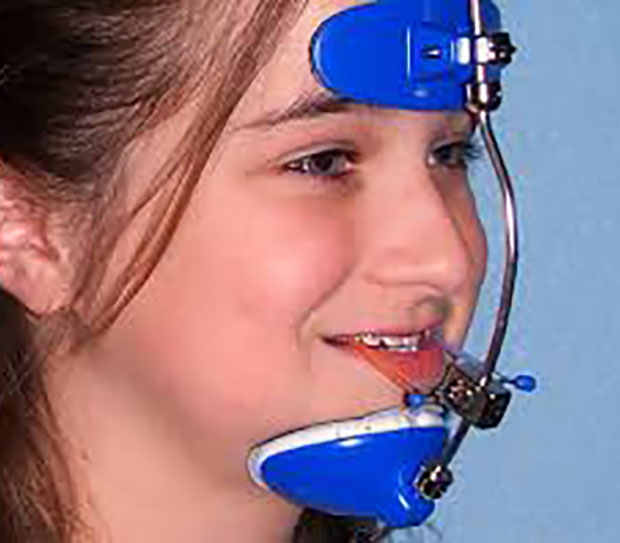 Headgear for Jaw Alignment