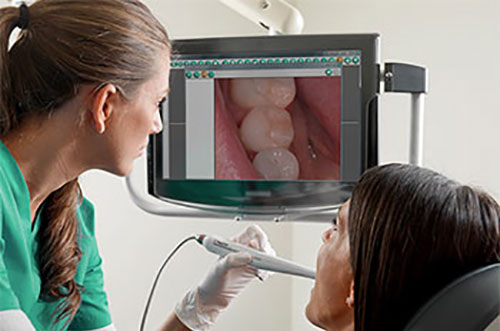 Intraoral Camera - Digital Dental Equipment