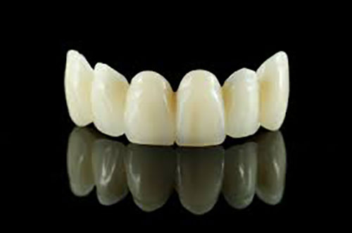 Artificial Porcelain Dental Bridge
